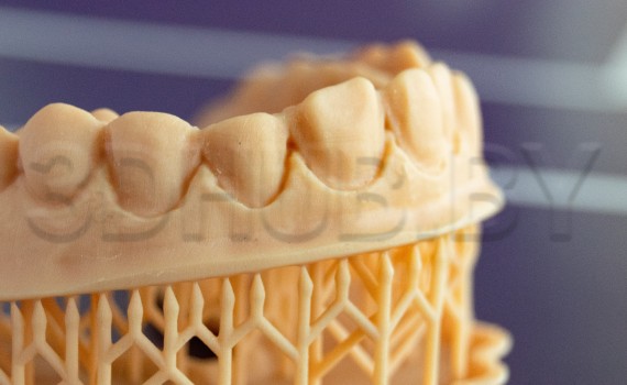 Модель из Dental Model Resin