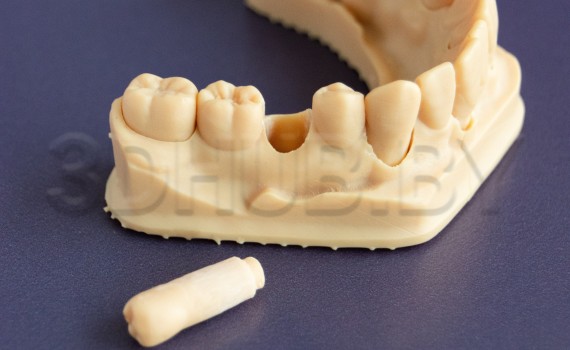Разборная модель Геллера из Dental Model Resin