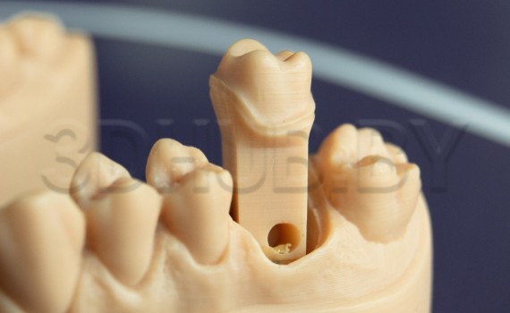 Разборная модель Геллера из Dental Model Resin