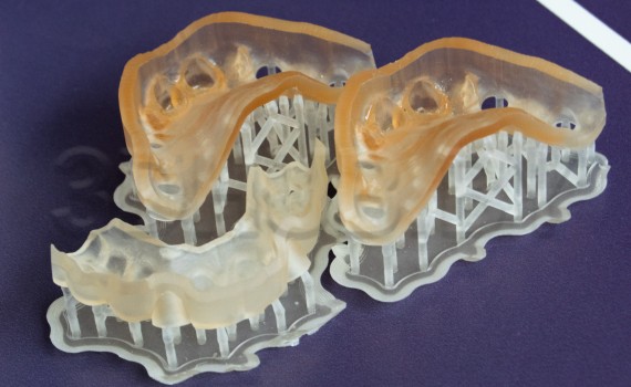 Хирургический шаблон из стерилизуемого Dental SG Resin
