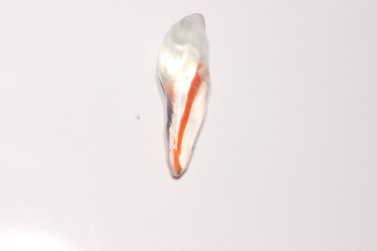 Модель зуба до и после прокраски каналов контрастным красителем